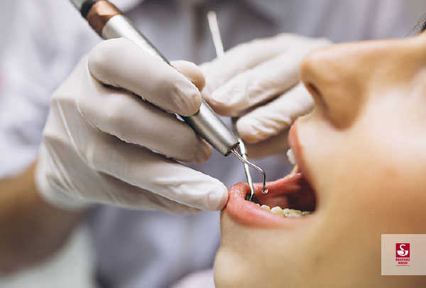 Miasis oral