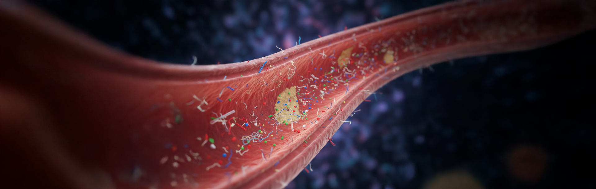 Un Causante Más De Enfermedad Del Corazón  - Siegfried Rhein Sigfrid