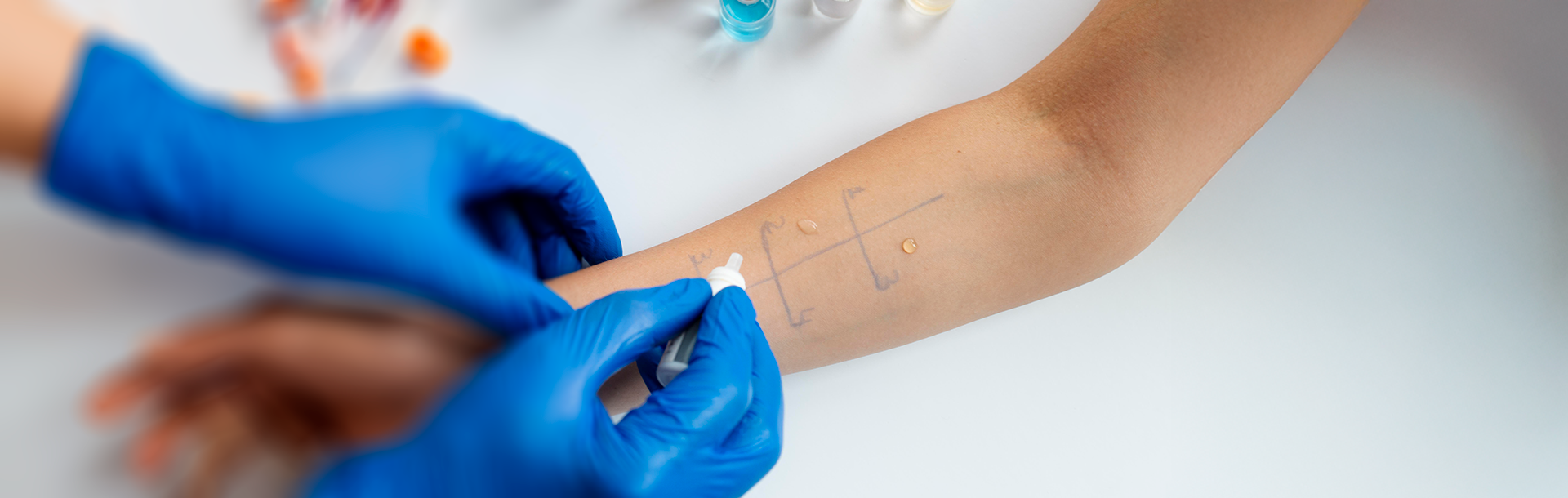 ¿Naces con alergias o las desarrollas?... - Siegfried Rhein Sigfrid