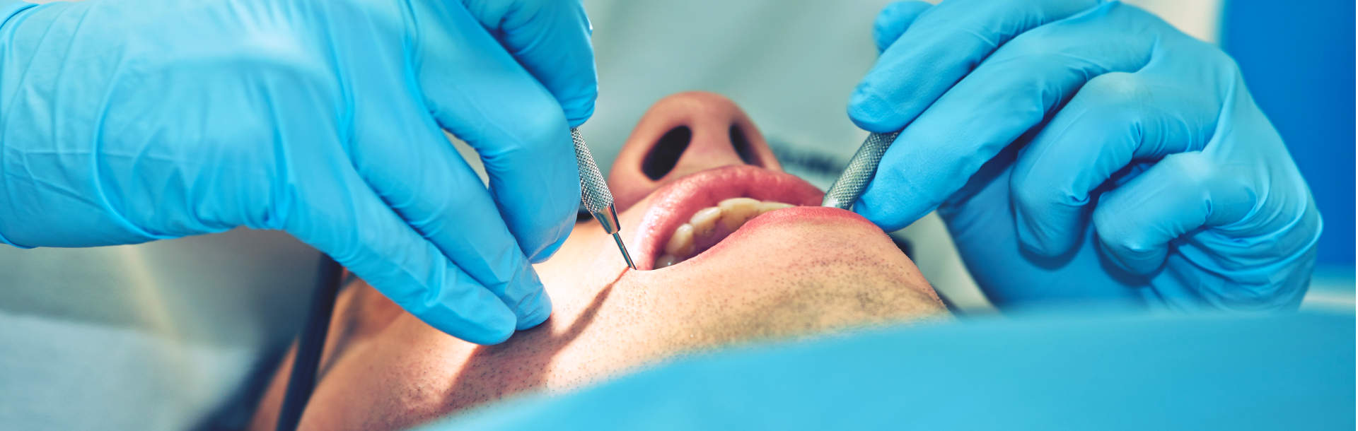 ¿Por qué es tan importante  la odontología preventiva? - Siegfried Rhein Sigfrid